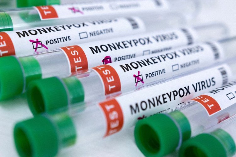 5 Fakta Penting Tentang Cacar Monyet Dan Vaksin Yang Disetujui FDA
