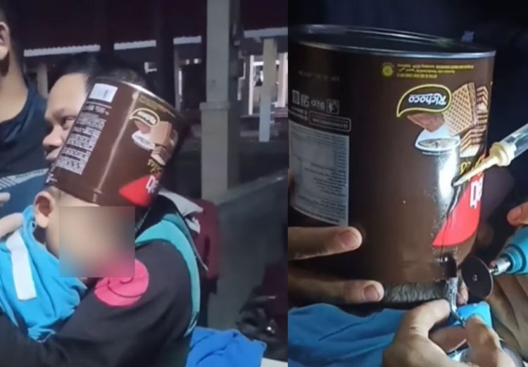 Viral Video Kepala Balita di Tasikmalaya Tersangkut Kaleng Wafer