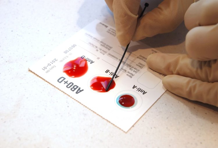 Langka! Dokter di China Temukan Subtipe Golongan Darah P